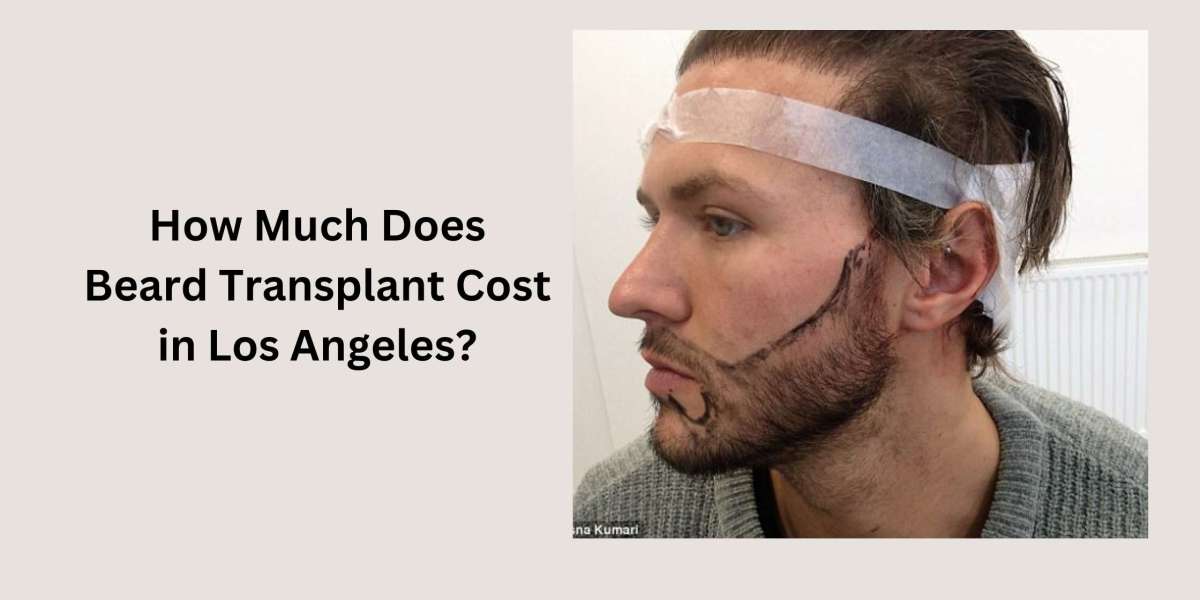 How Much Does Beard Transplant Cost in Los Angeles