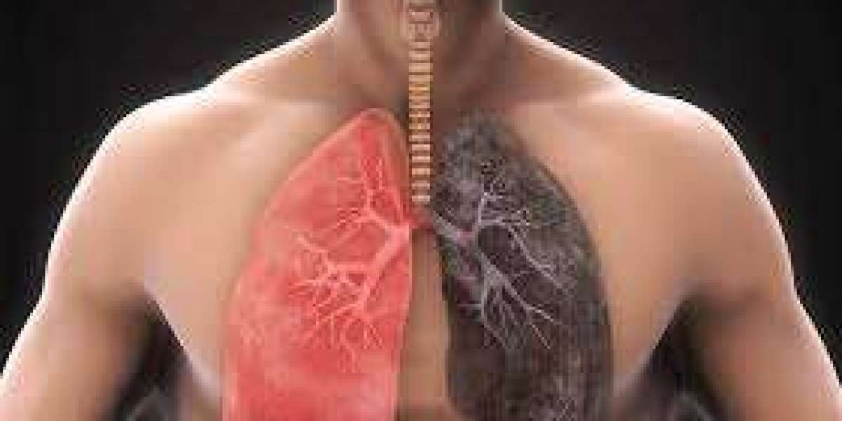 Chronic Obstructive Pulmonary Disease (COPD) Market Analysis Size And Forecast Report 2024-2032