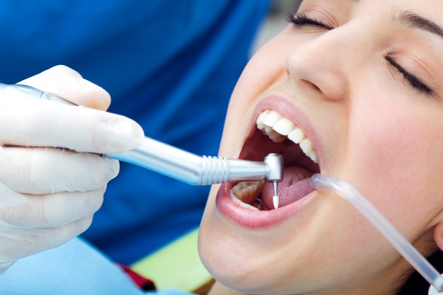 Dental Services: General & Cosmetic Dentistry in Roseville, CA