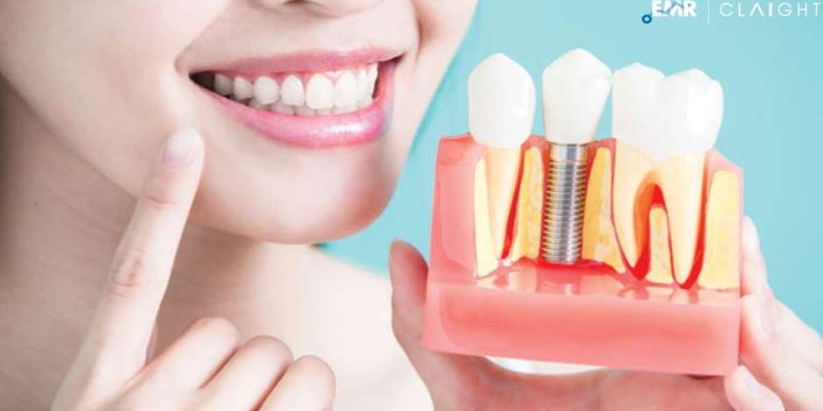 Global Aesthetic Implants Market Size, Share, Trends, Growth, Analysis, & Outlook | 2025-2034